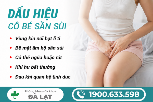 Hình ảnh minh họa